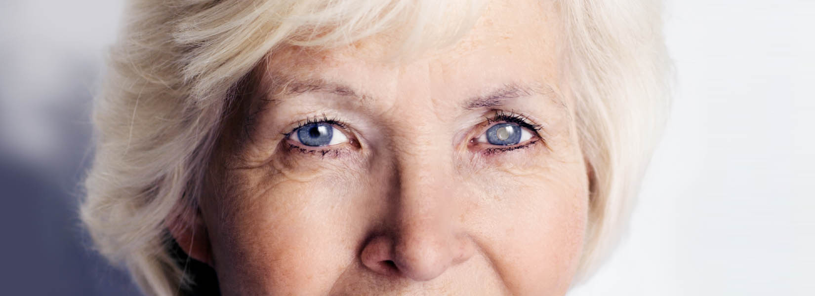 Cataract Surgery in Lincoln Park